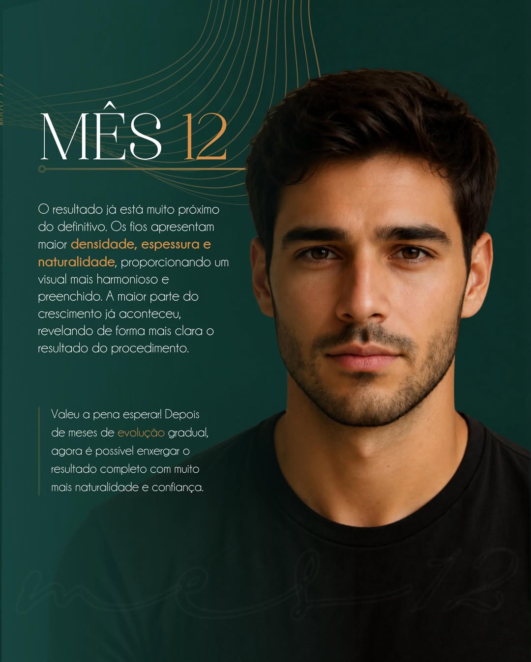 Mês 12 — Resultado quase final